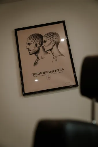 30% de remise sur votre micropigmentation capillaire chez Trichopigmentea à Casteljaloux, Casteljaloux, Trichopigmentea