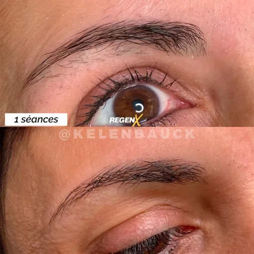 Sourcils trop fins : le protocole RegenX de repousse des poils, Casteljaloux, Trichopigmentea