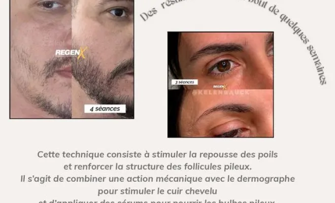 Protocole RegenX, Casteljaloux, Trichopigmentea