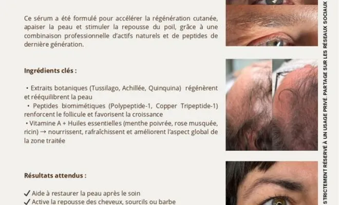 Protocole RegenX, Casteljaloux, Trichopigmentea